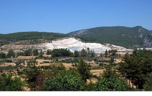 Diyetisyen Sümeyra Gözüm Uyarıyor: Hangi Vücut Tipi Daha Riskli? Elma Mı, Armut Mu?